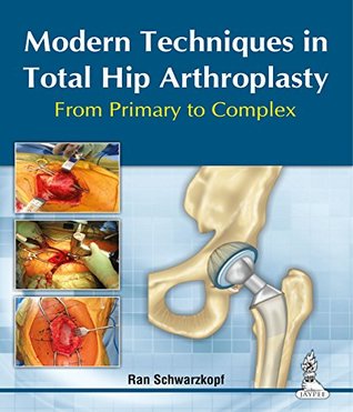 Full Download Modern Techniques in Total Hip Arthroplasty From Primary to Complex - Schwarzkopf Ran file in PDF